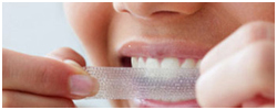 Whitening the teeth, Tooth Whitening, Teeth Whitening, Teeth whitening costs, Zoom teeth whitening